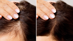 jujube promotes hair growth